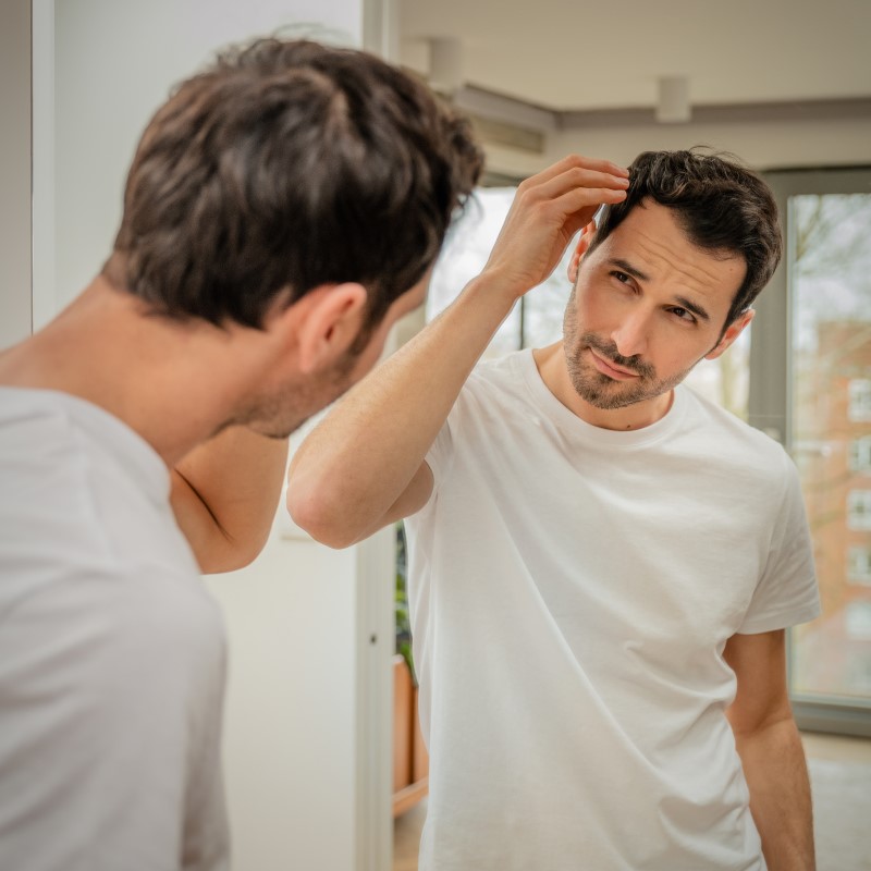Male Hair Loss