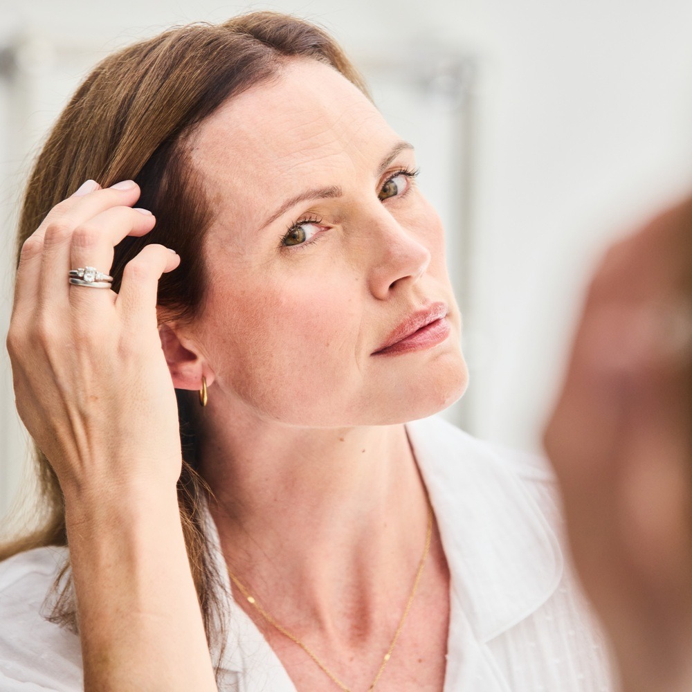 Female Pattern Hair Loss