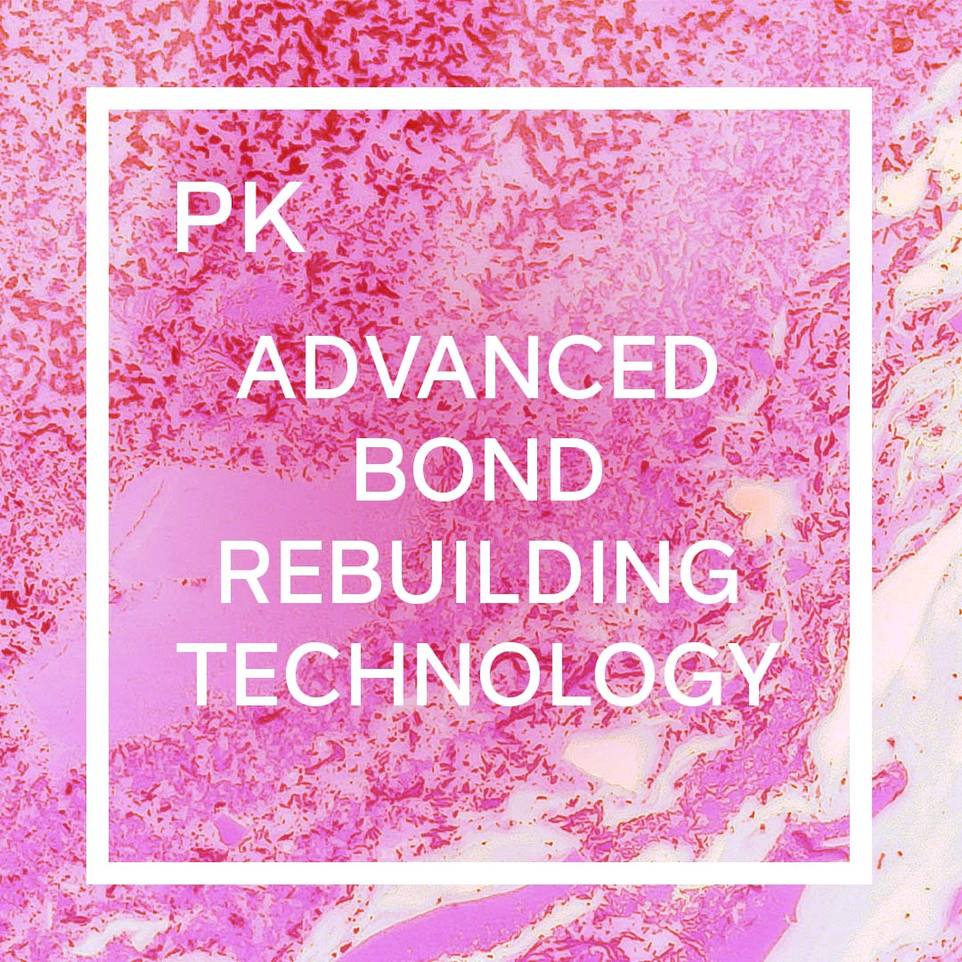 Advanced Bond Builder Technology