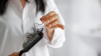 Hair Loss Myths Debunked: Expert Advice From Our Trichologists
